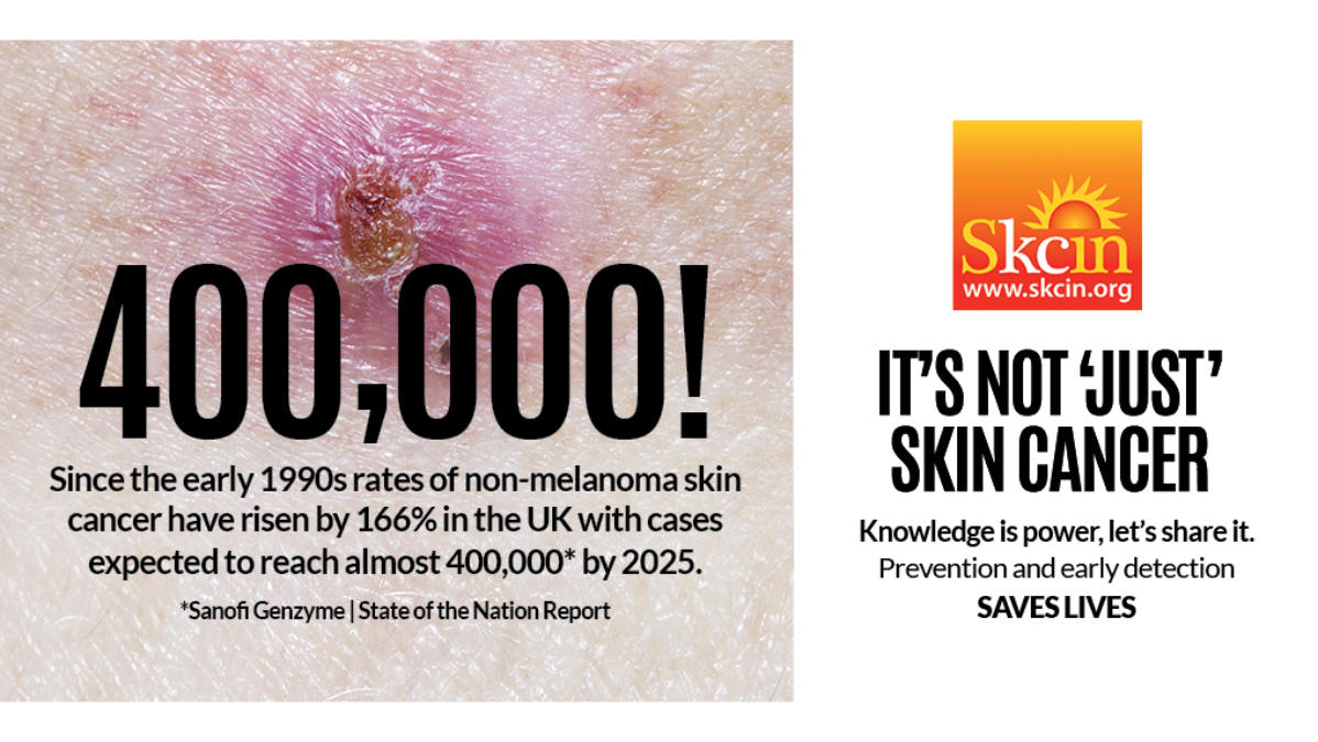 Skin Cancer Awareness Month 3.jpg